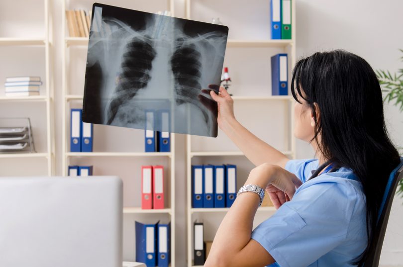 Woman looking at lung cancer scan. Radon Awareness.